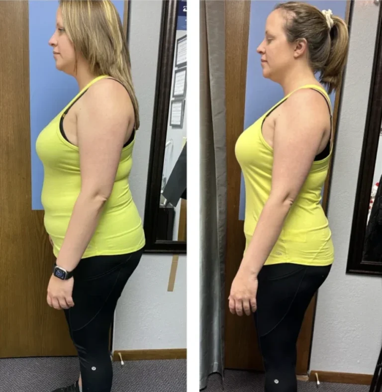 Wellness to weight loss Nuovo Te Madison, WI