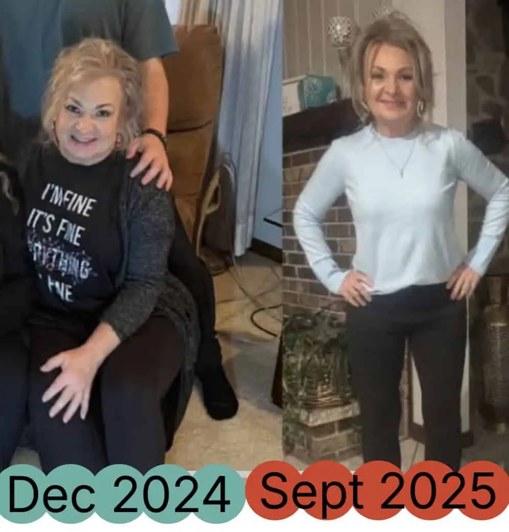 Peptides for Weight Loss in Madison, WI-Before-After (3)