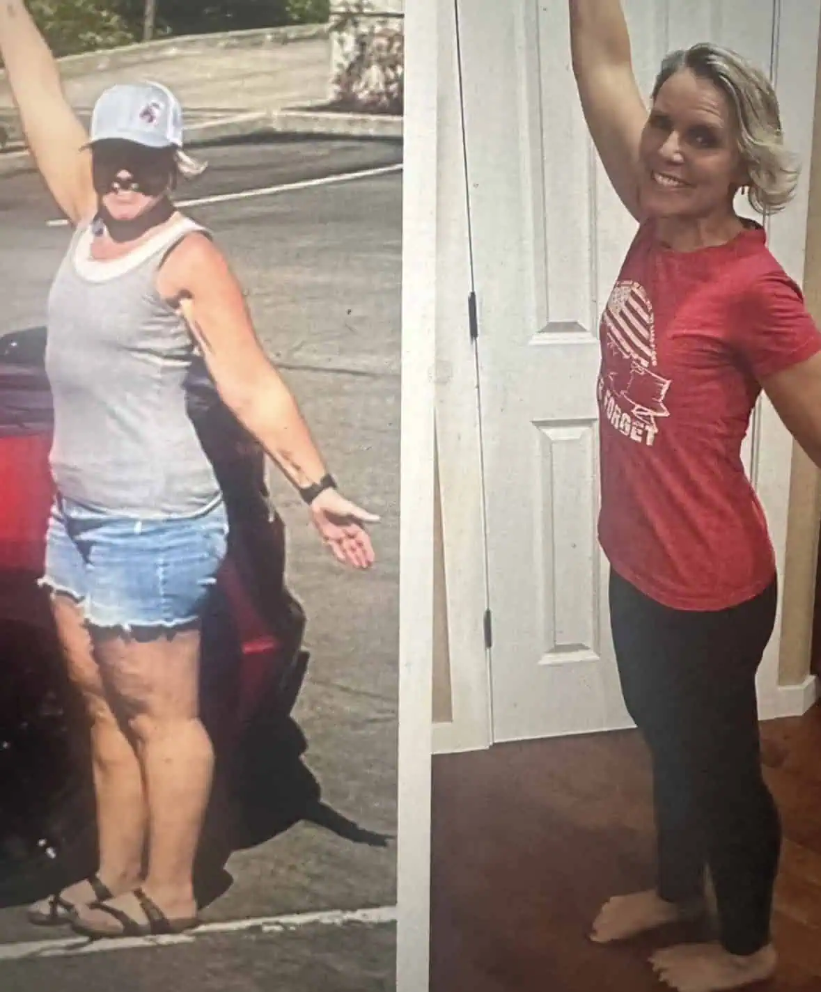 Peptides for Weight Loss in Madison, WI-Before-After (4)