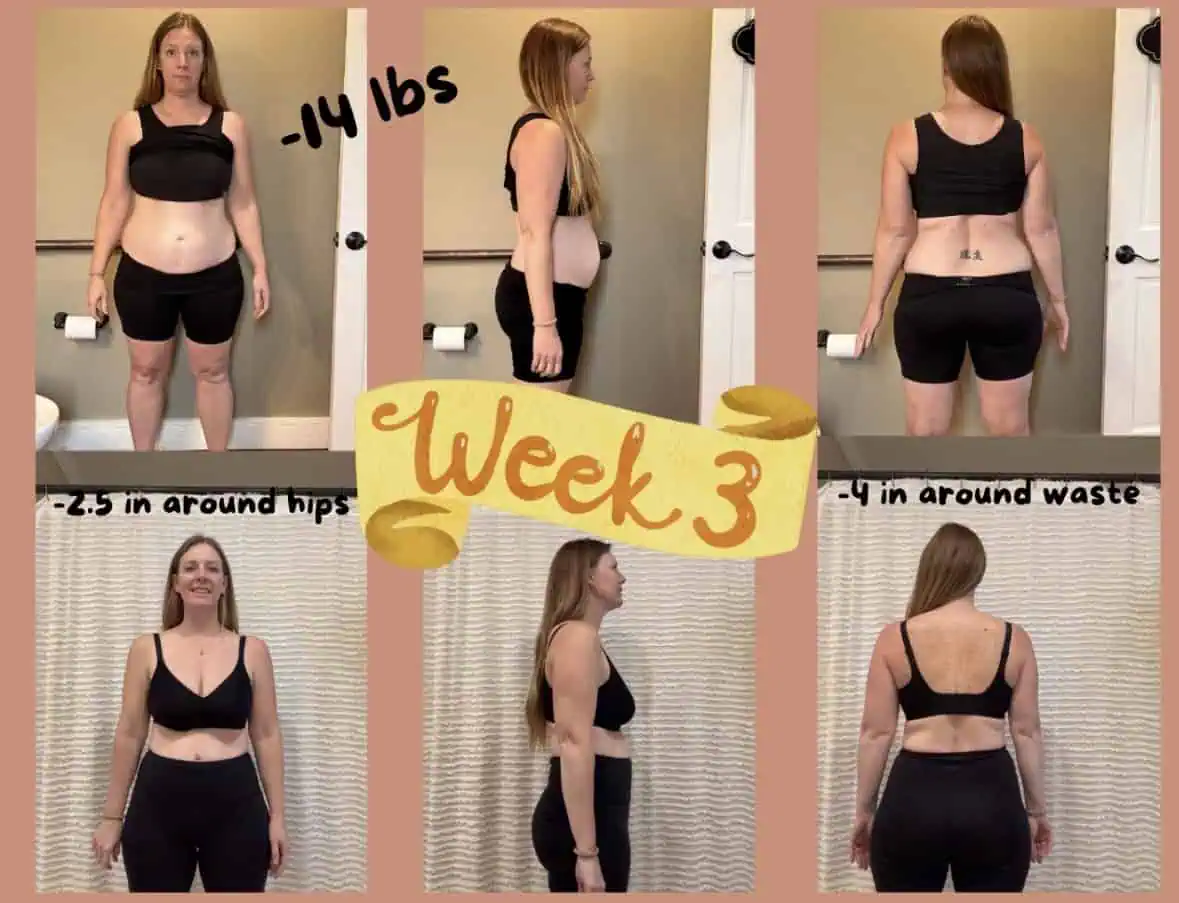 Peptides for Weight Loss in Madison, WI-Before-After (5)