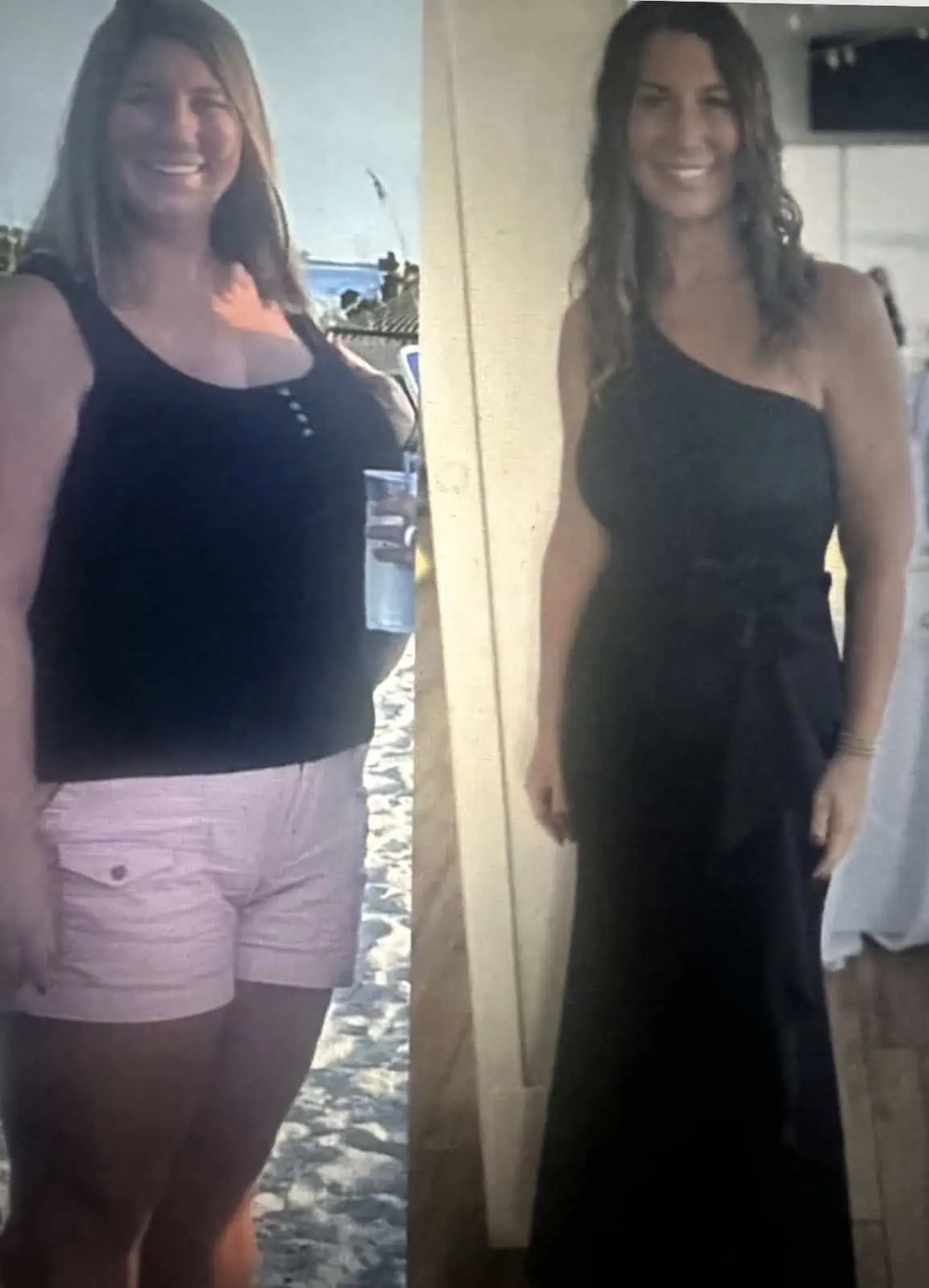 Peptides for Weight Loss in Madison, WI-Before-After (6)