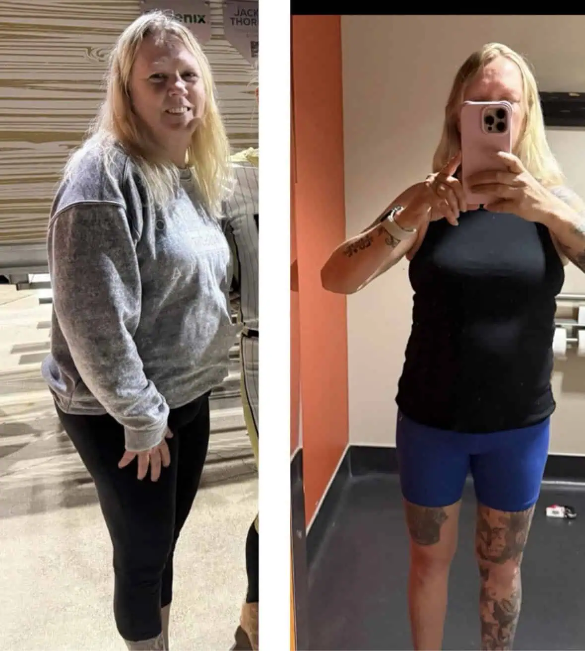 Peptides for Weight Loss in Madison, WI-Before-After (7)