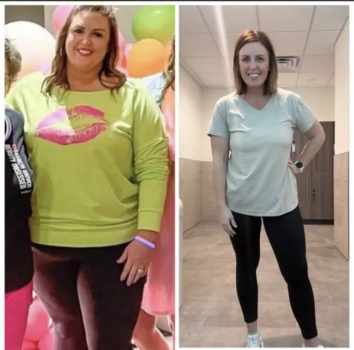 Peptides-for-Weight-Loss-in-Madison-WI-Before-After (8)